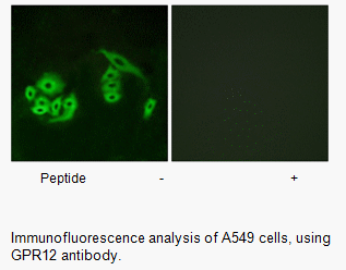 Product image for GPR12 Antibody