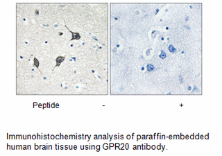 Product image for GPR20 Antibody