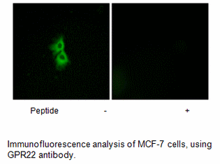 Product image for GPR22 Antibody