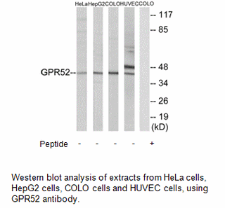 Product image for GPR52 Antibody