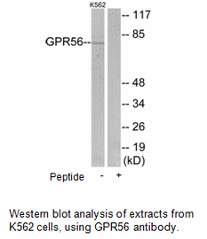 Product image for GPR56 Antibody