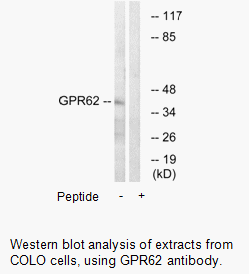 Product image for GPR62 Antibody