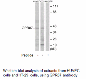 Product image for GPR87 Antibody
