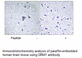 Product image for GRM1 Antibody