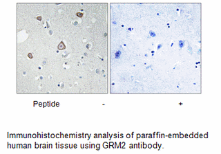 Product image for GRM2 Antibody