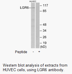 Product image for LGR6 Antibody