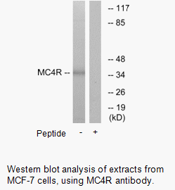 Product image for MC4R Antibody