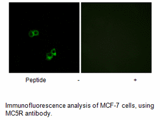 Product image for MC5R Antibody