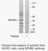 Product image for MCHR2 Antibody