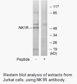 Product image for NK1R Antibody
