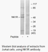 Product image for NK1R Antibody