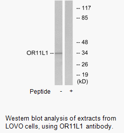 Product image for OR11L1 Antibody
