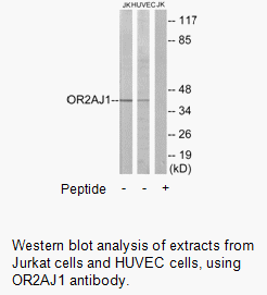 Product image for OR2AJ1 Antibody