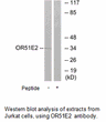 Product image for OR51E2 Antibody