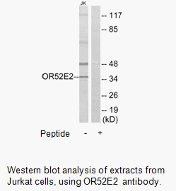 Product image for OR52E2 Antibody