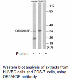 Product image for OR5AK3P Antibody