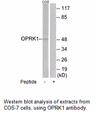 Product image for OPRK1 Antibody
