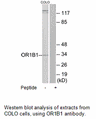 Product image for OR1B1 Antibody