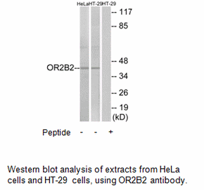 Product image for OR2B2 Antibody