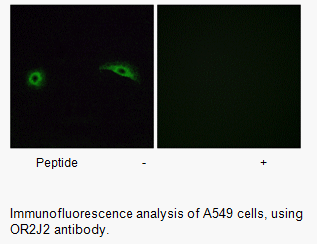 Product image for OR2J2 Antibody