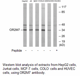 Product image for OR2M7 Antibody