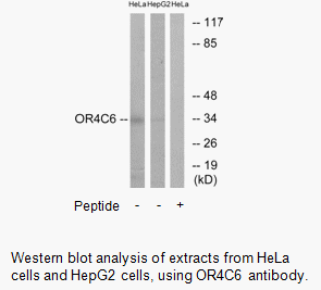 Product image for OR4C6 Antibody