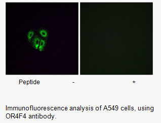 Product image for OR4F4 Antibody