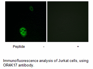 Product image for OR4K17 Antibody