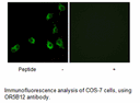 Product image for OR5B12 Antibody
