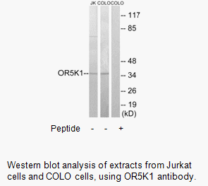 Product image for OR5K1 Antibody