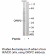 Product image for OR5P2 Antibody