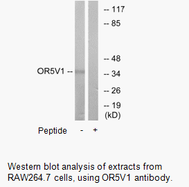 Product image for OR5V1 Antibody