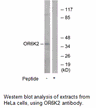 Product image for OR6K2 Antibody
