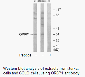 Product image for OR6P1 Antibody