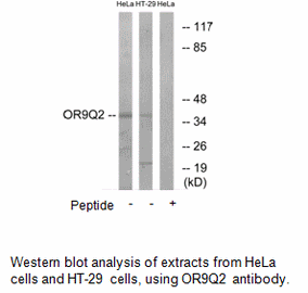Product image for OR9Q2 Antibody