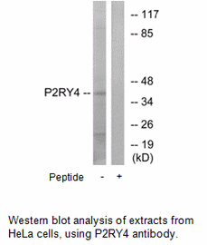Product image for P2RY4 Antibody