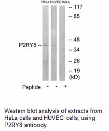Product image for P2RY8 Antibody