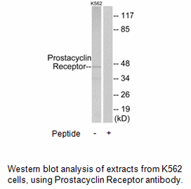Product image for Prostacyclin Receptor Antibody