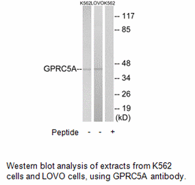 Product image for GPRC5A Antibody