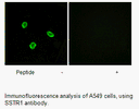 Product image for SSTR1 Antibody