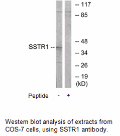Product image for SSTR1 Antibody