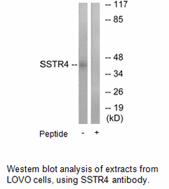 Product image for SSTR4 Antibody
