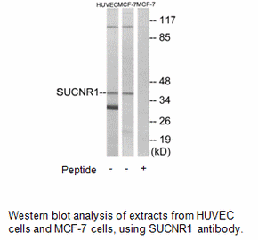 Product image for SUCNR1 Antibody