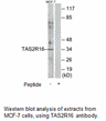 Product image for TAS2R16 Antibody