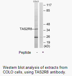 Product image for TAS2R8 Antibody