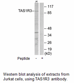 Product image for TAS1R3 Antibody