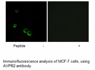 Product image for AVPR2 Antibody