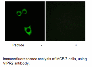 Product image for VIPR2 Antibody