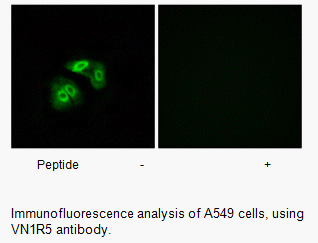 Product image for VN1R5 Antibody