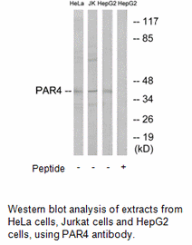 Product image for PAR4 Antibody
